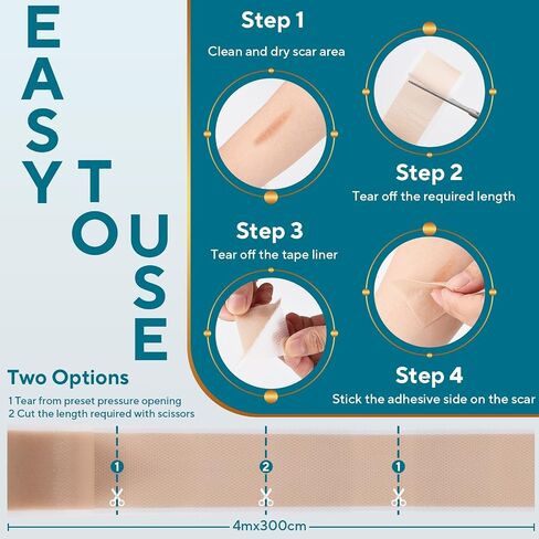 Silicone Scar Sheets, Silicone Scar Tape, Reusable Scar Silicone Strips for Scar Removal Treatment, Soft Silicone Scar Sheets for Surgical Scars, Keloid, C-Section, Burn et(1.6" x 59" Roll-1.5M) in Saudi Arabia