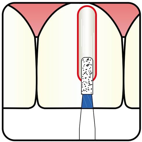 107.10m2 ، اسطوانة ، 1 مم ضياء ، بورت ماس ​​متوسطة الحصى ، 5 لكل عبوة in Kuwait