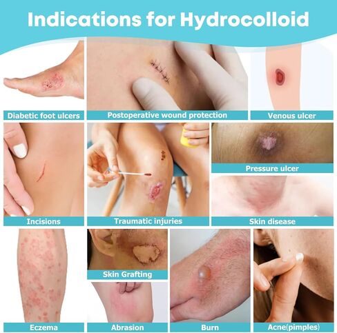 LIFARA Hydrocolloid Roll for Wound Care (WHC316R) - HSA FSA Eligible, 3in*16ft, 11.8mil/ 0.3mm Thickness, Medical Grade in Saudi Arabia