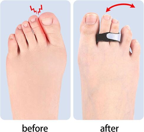 5pieces Finger Straps Portable Finger Splint Straps Finger Alignment Tool for Injured Finger and Swollen Relief in Saudi Arabia