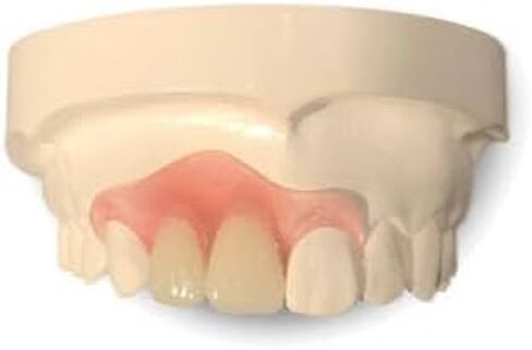 Best Option on Amazon – SD-Veneers.com – Professionally Made – Perfect fit – Natural Look – Premium Partial – Removable Denture – San Diego – in Saudi Arabia