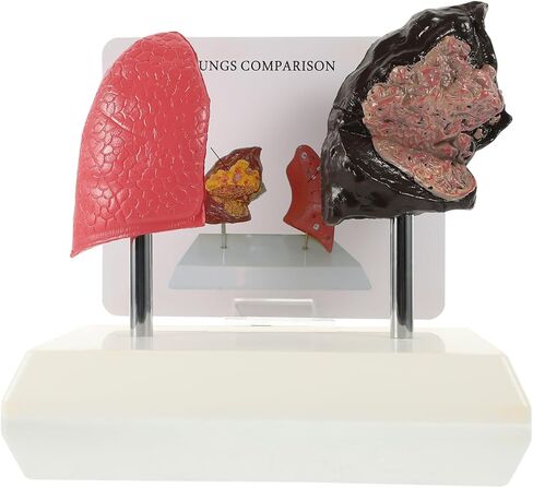Cabilock Smoking Lung Model and Normal Lung Comparison - Realistic PVC Anatomy Model for Medical Teaching Education and Health Studies in Saudi Arabia