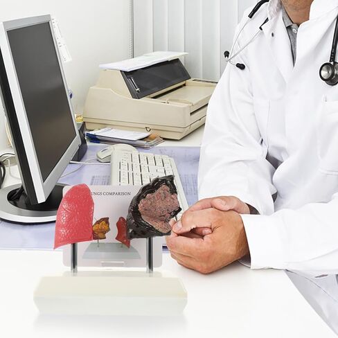Cabilock Smoking Lung Model and Normal Lung Comparison - Realistic PVC Anatomy Model for Medical Teaching Education and Health Studies in Saudi Arabia