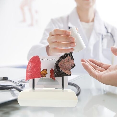 Cabilock Smoking Lung Model and Normal Lung Comparison - Realistic PVC Anatomy Model for Medical Teaching Education and Health Studies in Saudi Arabia