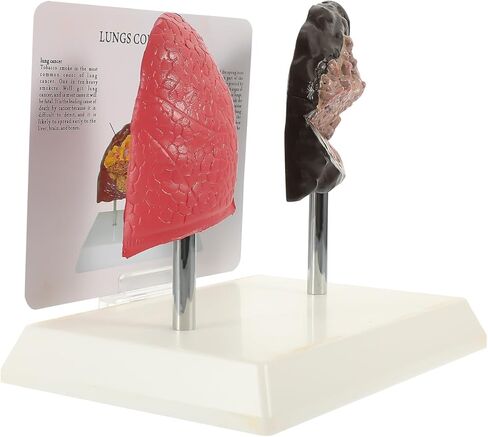 Cabilock Smoking Lung Model and Normal Lung Comparison - Realistic PVC Anatomy Model for Medical Teaching Education and Health Studies in Saudi Arabia