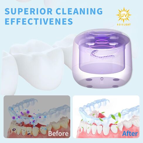 Ultrasonic Retainer Cleaner for Aligners & Mouth Guards, 45KHz Sonic Cleaning Machine with 2 Modes, 300ML Capacity - Safe for Jewelry & Daily Oral Care in Saudi Arabia