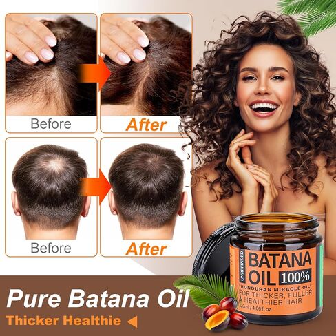 Unrefined Batana Oil for Hair Growth, Dr. Sebi Raw Batana Oil from Honduras, Hair Mask Hair Growth oil with Organic and Natural Ingredients, Espresso Coffee (2 fl oz, Espresso Coffee) in Kuwait