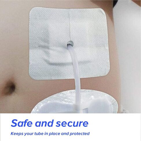 15 pcs تقسيم التصريف اللصق ضمادات أنبوب التغذية ، جهاز تثبيت القسطرة المعقمة ، أغطية الأنبوب G ، ربط شق supra-pubic الذي يحد من شاش ، 4 "× 4" خلع الملابس للرعاية التمريضية in Saudi Arabia