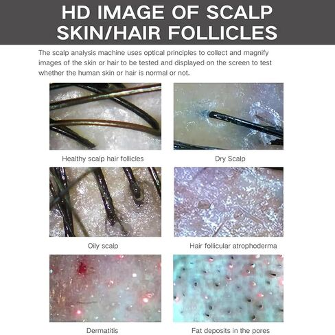 10in Skin Diagnosis Hair Analyzer, Scalp Hair Follicle Detector, with 5 Handles, Hair Analyzer for Home Salon Spa(10in) in Saudi Arabia