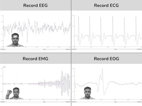 حبوب منع الحمل Bioamp exg (تجميع) | حزمة 1 | مستشعر درجة النشر لتسجيل EEG ، EMG ، EOG ، ECG | رأسا على عقب مختبرات in Saudi Arabia
