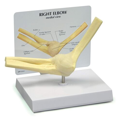 GPI Anatomicals - Foot and Ankle Model, Replica of Foot and Ankle with Plantar Fasciitis for Human Anatomy and Physiology Education, Anatomy Model for Doctor's Office, Medical Learning Resources in Kuwait