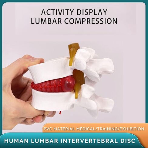 Human Anatomical Lumbar Disc Herniation Model, 1.5X Life-Size Herniated Lumbar Vertebrae Spine Model for Medical Teaching, Patient Education, Classroom Learning & Demonstration in Saudi Arabia