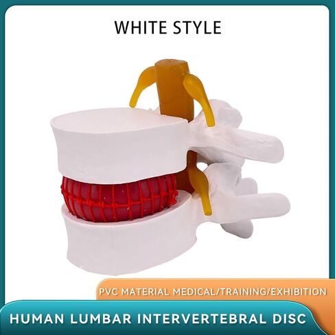 Human Anatomical Lumbar Disc Herniation Model, 1.5X Life-Size Herniated Lumbar Vertebrae Spine Model for Medical Teaching, Patient Education, Classroom Learning & Demonstration in Saudi Arabia