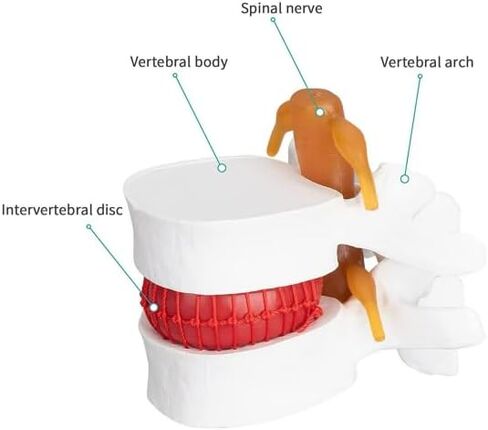 Human Anatomical Lumbar Disc Herniation Model, 1.5X Life-Size Herniated Lumbar Vertebrae Spine Model for Medical Teaching, Patient Education, Classroom Learning & Demonstration in Saudi Arabia
