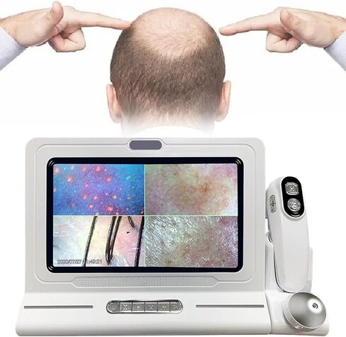 11 Inches Skin Diagnosis Hair Analyzer Machine w/HD LCD Screen Digital Skin Detector Moisture Tester,4-Picture Comparison & 16G Storage in Saudi Arabia