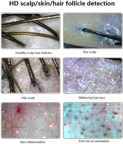 11 Inches Skin Diagnosis Hair Analyzer Machine w/HD LCD Screen Digital Skin Detector Moisture Tester,4-Picture Comparison & 16G Storage in Saudi Arabia