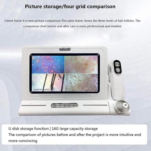 11 Inches Skin Diagnosis Hair Analyzer Machine w/HD LCD Screen Digital Skin Detector Moisture Tester,4-Picture Comparison & 16G Storage in Saudi Arabia
