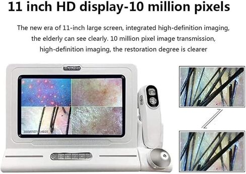 11 Inches Skin Diagnosis Hair Analyzer Machine w/HD LCD Screen Digital Skin Detector Moisture Tester,4-Picture Comparison & 16G Storage in Saudi Arabia