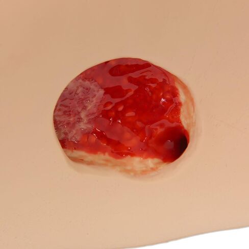 Seymour II" Wound Care Model, Light in Saudi Arabia
