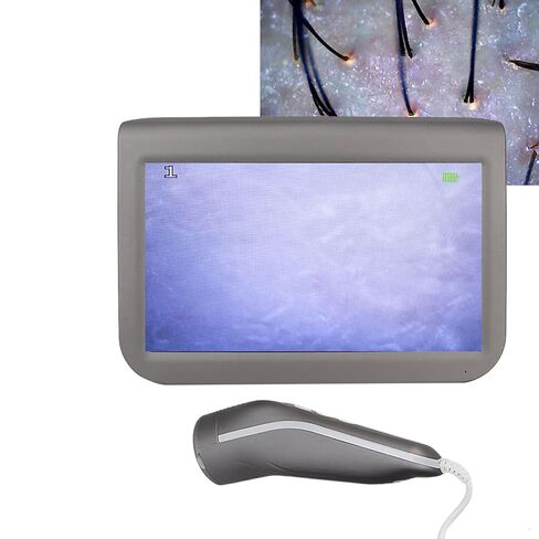 Scalp Hair Follicle Skin Hair Detector Analyser Machine Charging Type for Beauty Salon Nail (10.1 inch) in Saudi Arabia