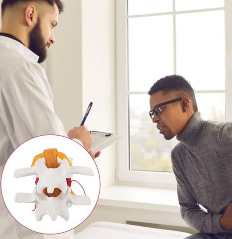 Human Lumbar Disc Herniation Model, 1.5 Times Durable and Lightweight Human Lumbar Disc Model, Visualized Anatomy of Lumbar Disc Herniation, Applied in Learning, Teaching, and Display in Saudi Arabia