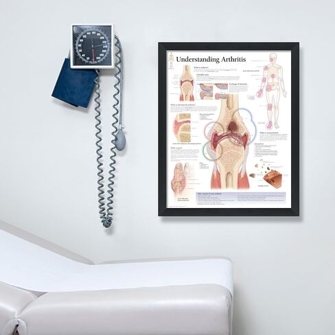Understanding Arthritis Framed Medical Educational Poster Informational Diagram Doctors Office School Classroom 22x28 Inches in Kuwait