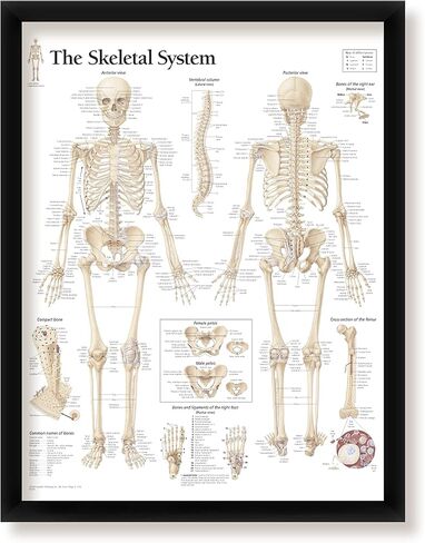 Understanding Arthritis Framed Medical Educational Poster Informational Diagram Doctors Office School Classroom 22x28 Inches in Kuwait