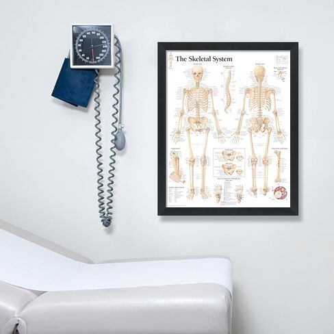 Understanding Arthritis Framed Medical Educational Poster Informational Diagram Doctors Office School Classroom 22x28 Inches in Kuwait
