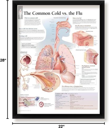 Understanding Arthritis Framed Medical Educational Poster Informational Diagram Doctors Office School Classroom 22x28 Inches in Kuwait