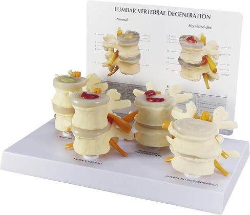 GPI Anatomicals - 4-Stage Vertebrae Model, Spine Model for Human Anatomy and Physiology Education, Anatomy Model for Doctor's Office and Classrooms, Medical Learning Resources in Kuwait