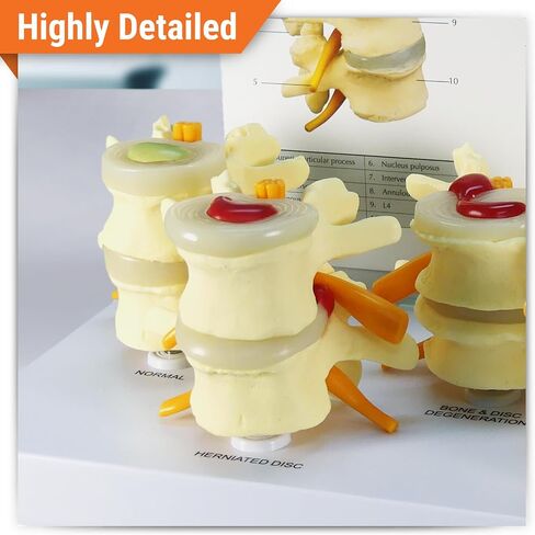 GPI Anatomicals - 4-Stage Vertebrae Model, Spine Model for Human Anatomy and Physiology Education, Anatomy Model for Doctor's Office and Classrooms, Medical Learning Resources in Kuwait