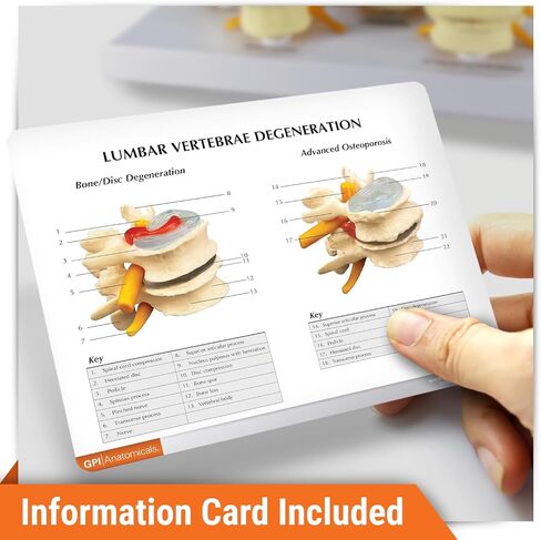GPI Anatomicals - 4-Stage Vertebrae Model, Spine Model for Human Anatomy and Physiology Education, Anatomy Model for Doctor's Office and Classrooms, Medical Learning Resources in Kuwait