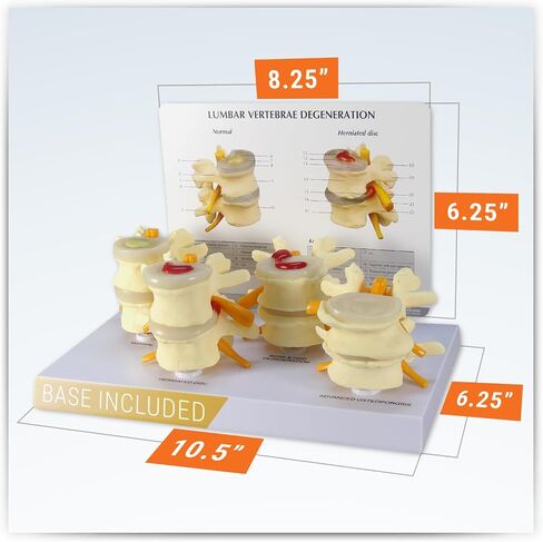 GPI Anatomicals - 4-Stage Vertebrae Model, Spine Model for Human Anatomy and Physiology Education, Anatomy Model for Doctor's Office and Classrooms, Medical Learning Resources in Kuwait