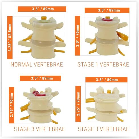 GPI Anatomicals - 4-Stage Vertebrae Model, Spine Model for Human Anatomy and Physiology Education, Anatomy Model for Doctor's Office and Classrooms, Medical Learning Resources in Kuwait
