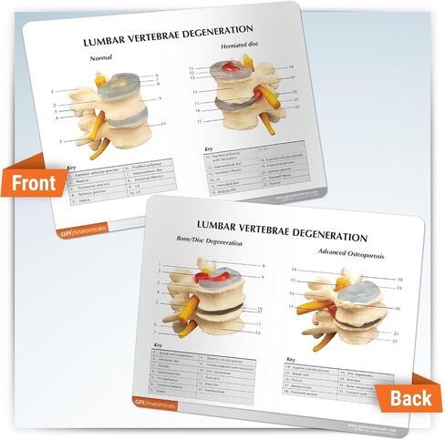 GPI Anatomicals - 4-Stage Vertebrae Model, Spine Model for Human Anatomy and Physiology Education, Anatomy Model for Doctor's Office and Classrooms, Medical Learning Resources in Kuwait