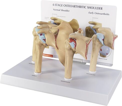 GPI Anatomicals - 4-Stage Vertebrae Model, Spine Model for Human Anatomy and Physiology Education, Anatomy Model for Doctor's Office and Classrooms, Medical Learning Resources in Kuwait