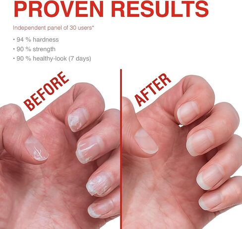 Probelle Nail Strengthening Formula, Nail Growth & Conditioning, Stops Splits, Chips, Cracks & Strengthens Nails, Clear in Saudi Arabia