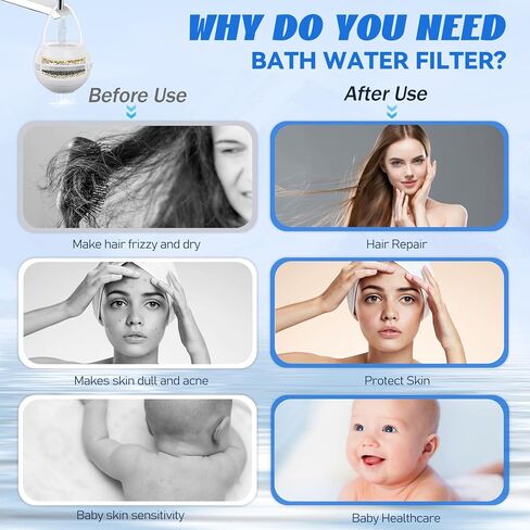 مرشح الحمام لحوض الصنبور FiteSpot ، مرشح مياه الحمام 2 خراطيش مرشحات 10 مراحل ترشيح ، مرشح الحمام صنبور 2500 جالون يزيل الكلور ، مرشح دش لشعر الجلد أكثر صحة (أبيض) in Kuwait