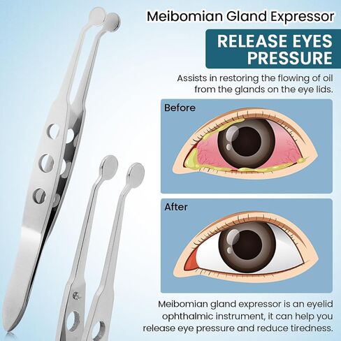 Meibomian Gland Expressor, Stainless Steel Eyelid Massage Tweezers, Professional Forceps Dryeye Extraction Tool for Men Women, Eye Care Tool For Dry Eyes(Round Tip,SIZE:5 * 5) in Kuwait