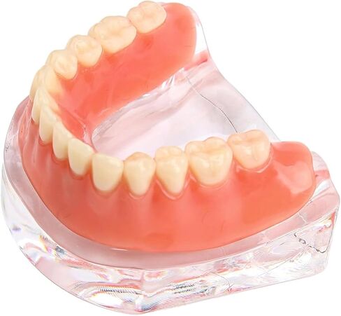 Dental Model Overdenture Transparent Dental Implants Model Detachable Model Lower Jaw Dental Teaching Model Suitable for Education and Study Silver in Saudi Arabia