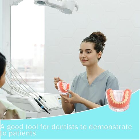 Dental Model Overdenture Transparent Dental Implants Model Detachable Model Lower Jaw Dental Teaching Model Suitable for Education and Study Silver in Saudi Arabia