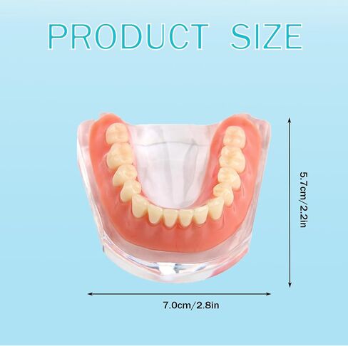 Dental Model Overdenture Transparent Dental Implants Model Detachable Model Lower Jaw Dental Teaching Model Suitable for Education and Study Silver in Saudi Arabia