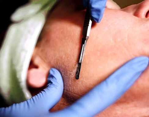 مقبض Scalpel Swann Morton No 3 للشفرات 10 و 10R و 11 و 15 و 15A لحمل شفرة الفولاذ المقاوم للصدأ و 2 حماة مقبض Scalple in Saudi Arabia