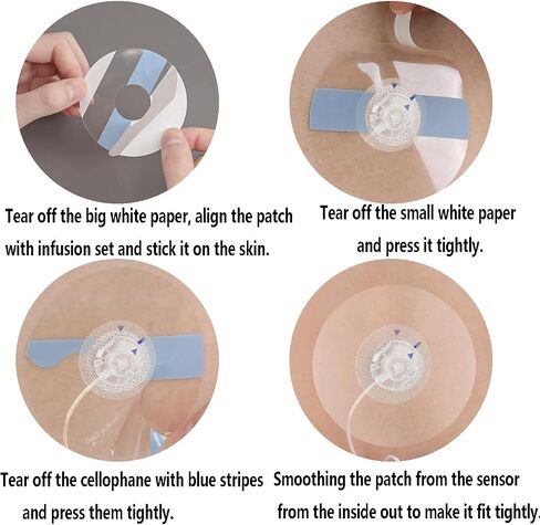 30 Pcs Waterproof Infusion Site CGM Adhesive Patches for Medtronic 780G/770G, Tandem t:Slim X2/ Mobi - Hypoallergenic Sensor Adhesive Tape with 0.8" Hole, 14-Day Wear, Pre-Cut Breathable Clear Patch in Saudi Arabia