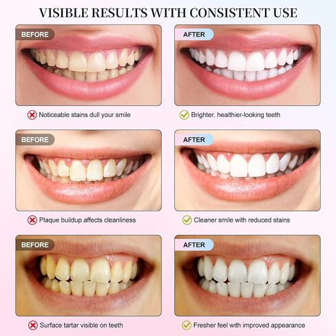 Niacinamide Whitening Toothpaste, 2 Pack Intensive Stain Removal Toothpaste for Yellow Teeth, Gum Care, Fresh Mint & Peach Breath, Tartar Control, Deep Clean for Men and Women, 3.5oz in Kuwait