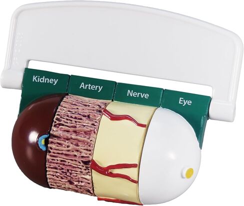 GPI Anatomicals - 4-Piece Colon Model, Replica of a Colon with Pathologies for Human Anatomy and Physiology Education, Anatomy Model for Doctor's Offices and Classrooms, Medical Learning Resources in Kuwait