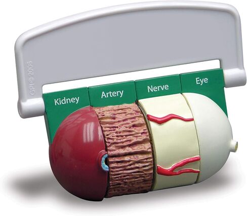 GPI Anatomicals - 4-Piece Colon Model, Replica of a Colon with Pathologies for Human Anatomy and Physiology Education, Anatomy Model for Doctor's Offices and Classrooms, Medical Learning Resources in Kuwait