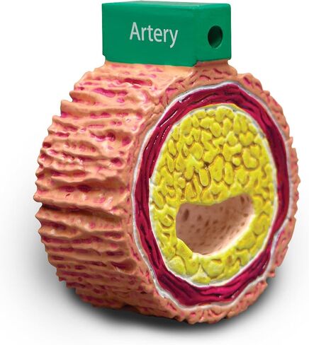 GPI Anatomicals - 4-Piece Colon Model, Replica of a Colon with Pathologies for Human Anatomy and Physiology Education, Anatomy Model for Doctor's Offices and Classrooms, Medical Learning Resources in Kuwait
