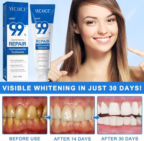 2pcs 9.9 ٪ معجون أسنان هيدروكسيباتيت لإصلاح المينا وتقوية الأسنان ، معجون أسنان هيدروكسيباتيت النانو ، نعش in Kuwait