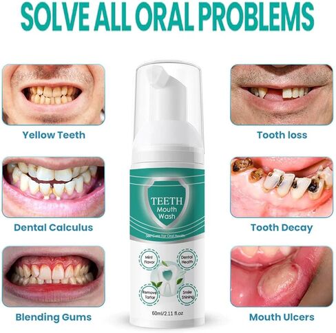 2PCS Foam Toothpaste,Stain Removal Toothpaste for Sensitive Teeth, Ultra-fine Mousse Foam, Deeply Cleans Gums, Removes Stains, Refreshes Breath (2) in Kuwait